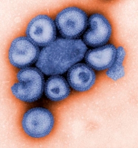 swine-flu-virus
